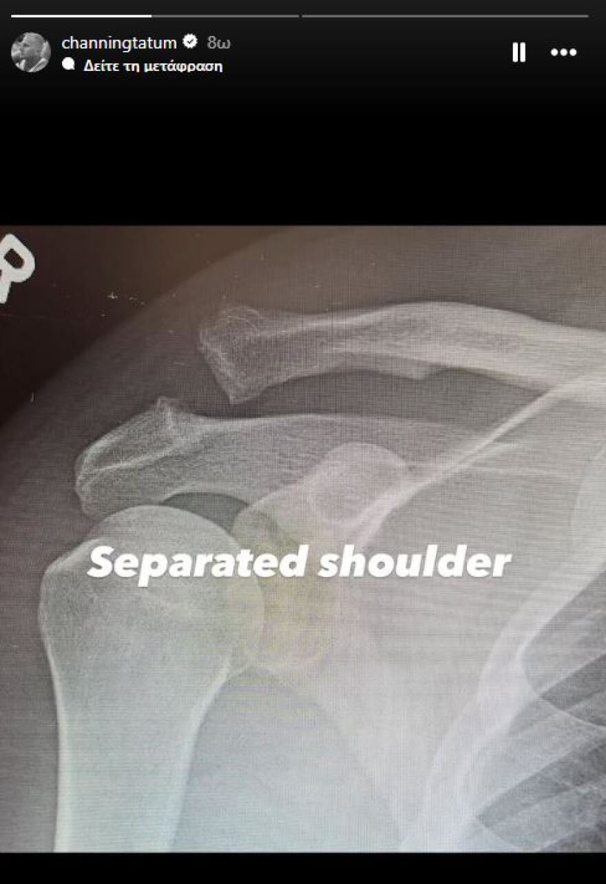 Στο νοσοκομείο ο Τσάνινγκ Τέιτουμ: Αυτό θα είναι δύσκολο, έγραψε