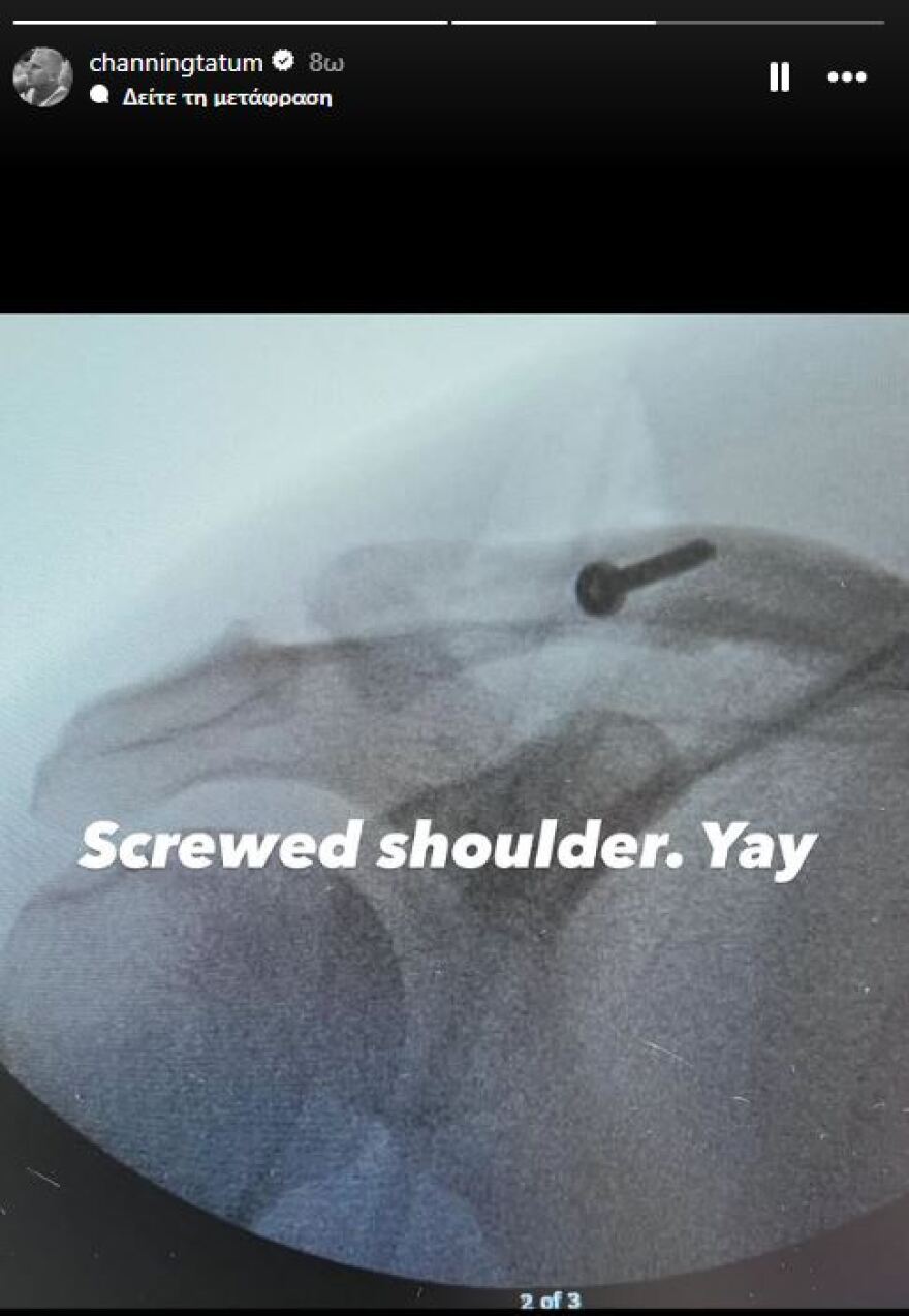 Στο νοσοκομείο ο Τσάνινγκ Τέιτουμ: Αυτό θα είναι δύσκολο, έγραψε