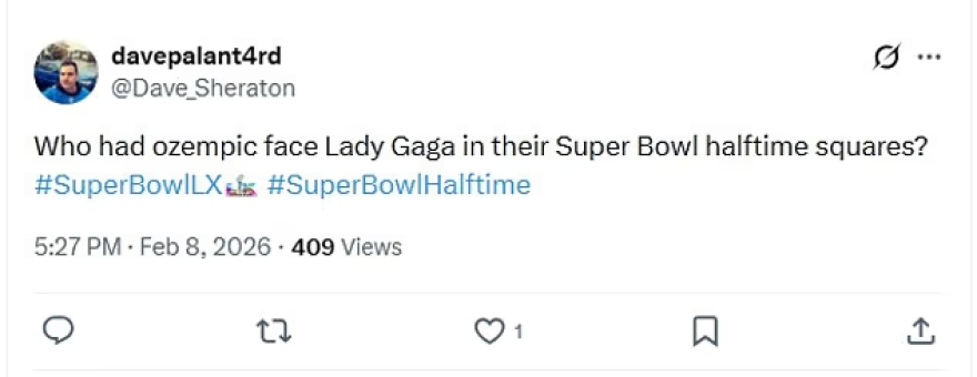 Αντιδράσεις για την εμφάνιση της Lady Gaga στο Super Bowl 2026: «Είναι AI ή η Lady Ozempic Gaga;»