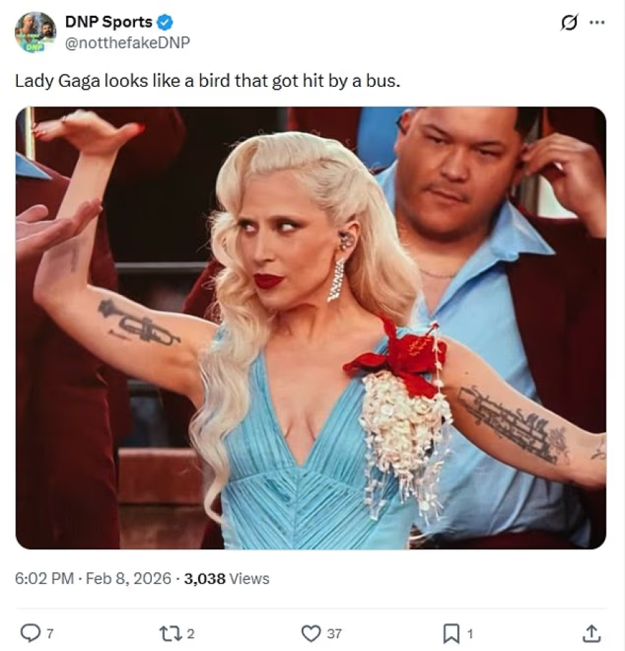 Αντιδράσεις για την εμφάνιση της Lady Gaga στο Super Bowl 2026: «Είναι AI ή η Lady Ozempic Gaga;»