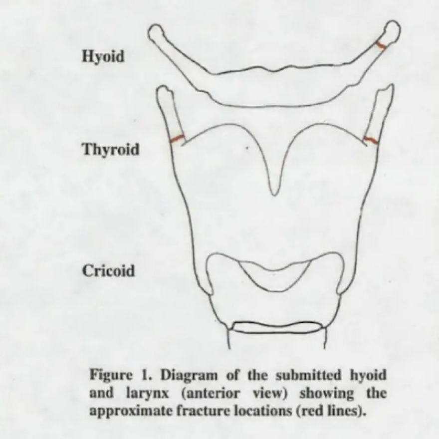 &Nu;έ&alpha; &epsilon;&rho;&omega;&tau;ή&mu;&alpha;&tau;&alpha; &gamma;&iota;&alpha; &tau;&omicron;&nu; &theta;ά&nu;&alpha;&tau;&omicron; &tau;&omicron;&upsilon; &Epsilon;&pi;&sigma;&tau;ά&iota;&nu;: &Iota;&alpha;&tau;&rho;&omicron;&delta;&iota;&kappa;&alpha;&sigma;&tau;ή&sigmaf; &mu;&iota;&lambda;ά &gamma;&iota;&alpha; &laquo;&pi;&iota;&theta;&alpha;&nu;ό &sigma;&tau;&rho;&alpha;&gamma;&gamma;&alpha;&lambda;&iota;&sigma;&mu;ό&raquo; &kappa;&alpha;&iota; &zeta;&eta;&tau;ά &epsilon;&pi;&alpha;&nu;&epsilon;&xi;έ&tau;&alpha;&sigma;&eta;