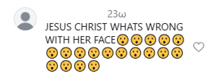 Αντιδράσεις για την εμφάνιση της Ρόζι Χάντινγκτον: «Χριστέ μου τι πάει λάθος με το πρόσωπό της;»