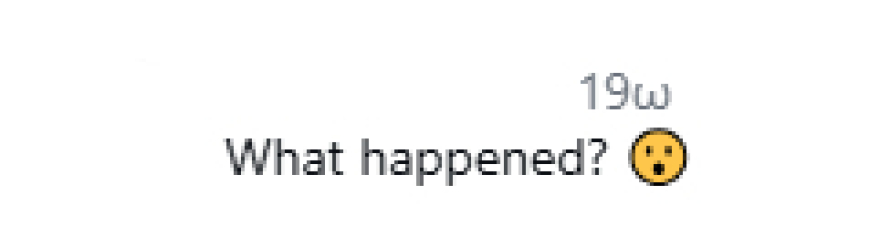 Αντιδράσεις για την εμφάνιση της Ρόζι Χάντινγκτον: «Χριστέ μου τι πάει λάθος με το πρόσωπό της;»