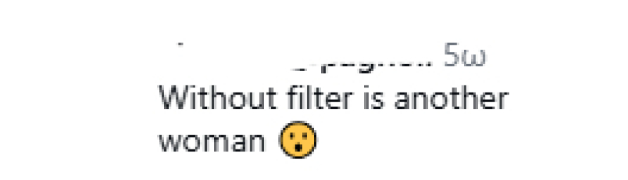 Αντιδράσεις για την εμφάνιση της Ρόζι Χάντινγκτον: «Χριστέ μου τι πάει λάθος με το πρόσωπό της;»