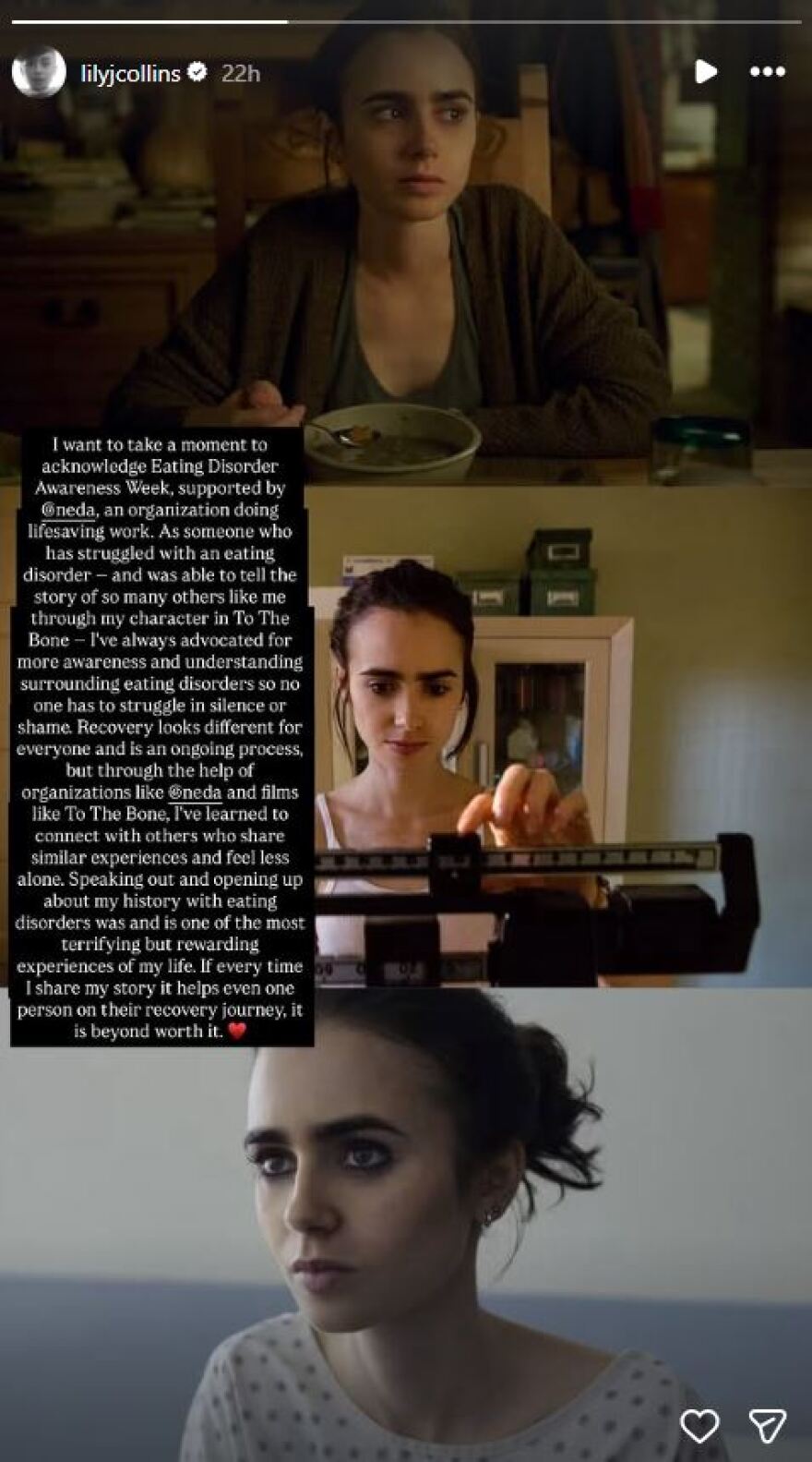 Λίλι Κόλινς: Το να μιλήσω για τη διατροφική διαταραχή ήταν μια από τις πιο τρομακτικές εμπειρίες της ζωής μου