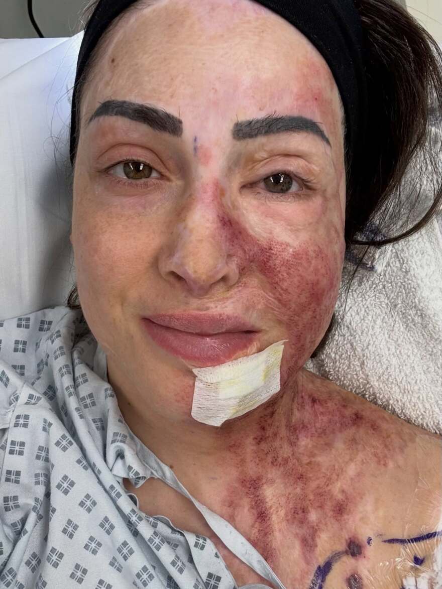 Συγκλονίζει η Ιωάννα Παλιοσπύρου με φωτογραφίες από την αποκατάστασή της: Χτίζω τον εαυτό μου ξανά