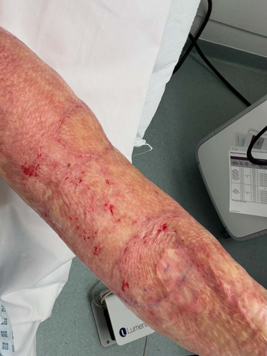 Συγκλονίζει η Ιωάννα Παλιοσπύρου με φωτογραφίες από την αποκατάστασή της: Χτίζω τον εαυτό μου ξανά