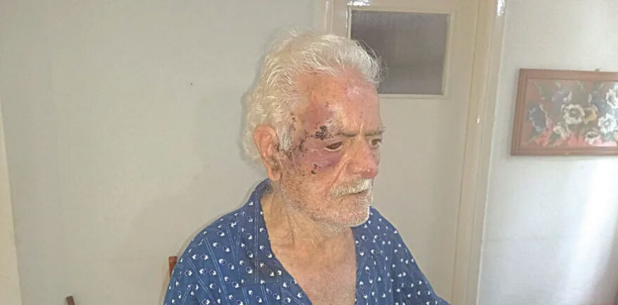 Άγρια ληστεία στην Πάτρα με θύματα ηλικιωμένο ζευγάρι που ξυλοξοπήθηκε μέσα στο σπίτι του