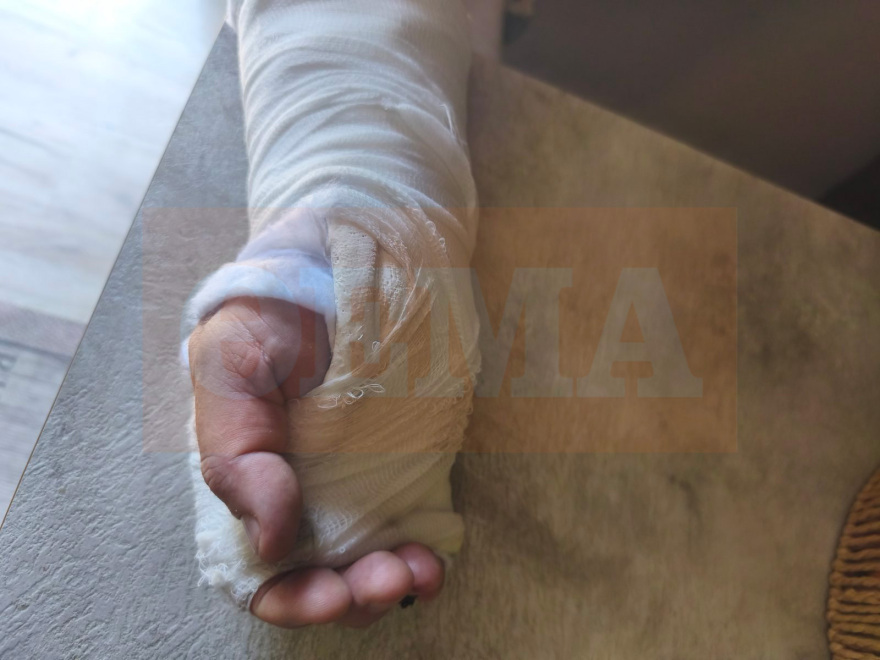 «Με χτυπούσαν στο κεφάλι 3 Πακιστανοί» λέει ο οδηγός του απορριμματοφόρου που ξυλοκοπήθηκε στη Νίκαια