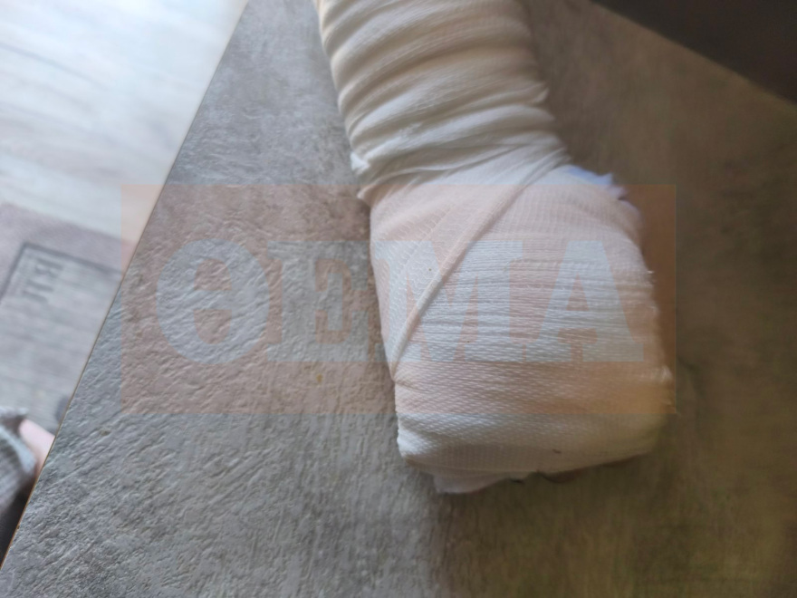 «Με χτυπούσαν στο κεφάλι 3 Πακιστανοί» λέει ο οδηγός του απορριμματοφόρου που ξυλοκοπήθηκε στη Νίκαια