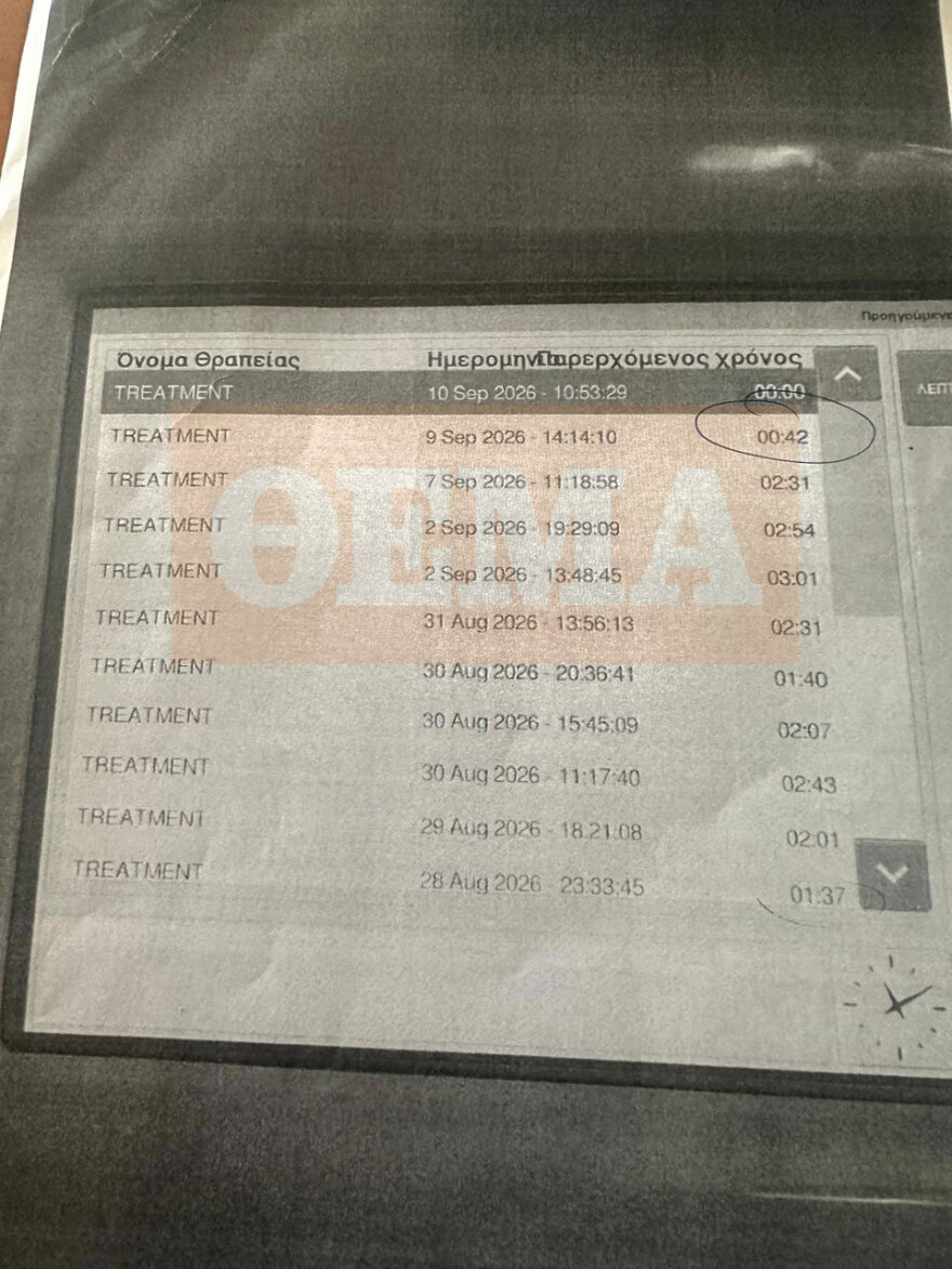 Δείτε το ντοκουμέντο που αποδεικνύει ότι ο Μαζωνάκης έκανε πλασμαφαίρεση επί 42 λεπτά, πριν υποστεί ανακοπή