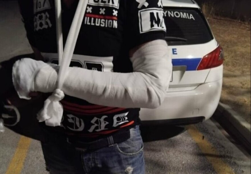 Ρομά στον Βόλο έσπασε με σκουπόξυλο το χέρι ταξιτζή που αρνήθηκε να επιβιβάσει τον ίδιο και τον πατέρα του, «πήγε να μου το μπήξει στην κοιλιά»