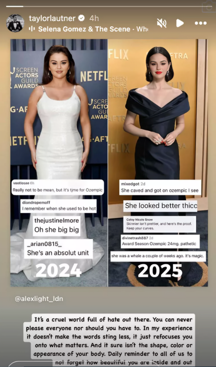 Σελένα Γκόμεζ: Ο Τέιλορ Λότνερ την στήριξε για τα σχόλια για τα κιλά της - «Ο κόσμος είναι σκληρός και γεμάτος μίσος»