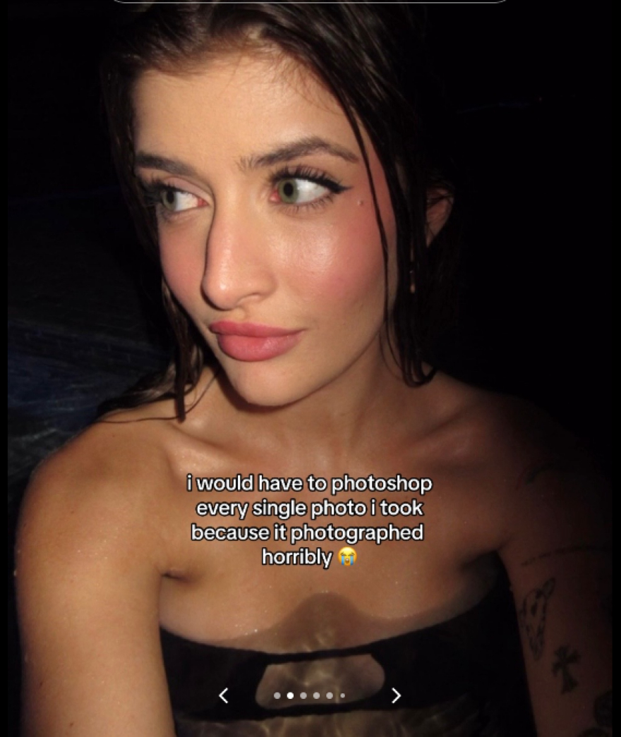 Τσάρλι Σιν: Η κόρη του υποβλήθηκε σε ρινοπλαστική, καθώς είχε δεχτεί bullying για την ομοιότητά της με τον πατέρα της