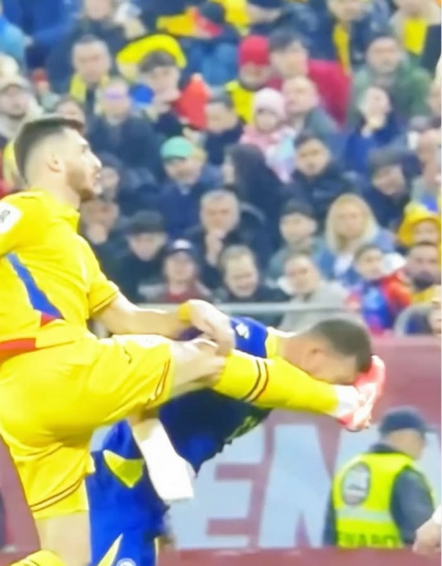 Σοκαριστικός τραυματισμός Τζέκο: Με σπασμένη μύτη και ράμματα ο Βόσνιος μετά από κλωτσιά στο πρόσωπο