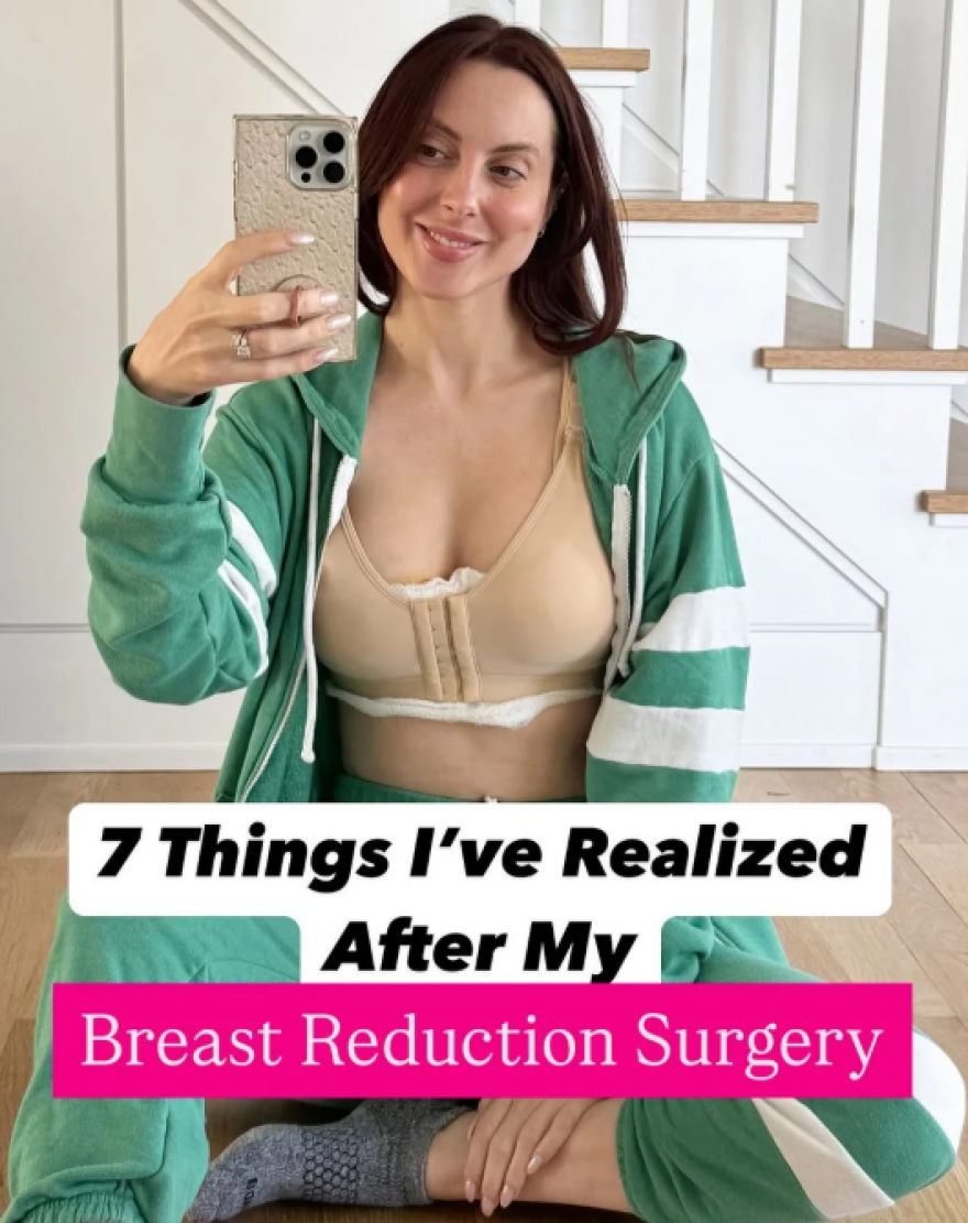 Η κόρη της Σούζαν Σαράντον υποβλήθηκε σε μειωτική στήθους μετά τα σχόλια που δέχτηκε στον γάμο της