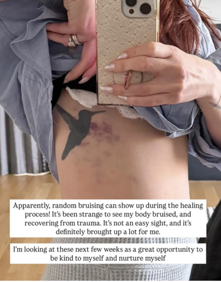 Η κόρη της Σούζαν Σαράντον υποβλήθηκε σε μειωτική στήθους μετά τα σχόλια που δέχτηκε στον γάμο της