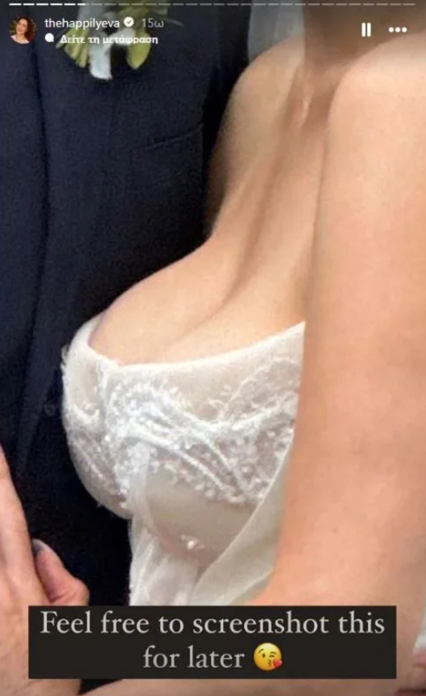 Η κόρη της Σούζαν Σαράντον υποβλήθηκε σε μειωτική στήθους μετά τα σχόλια που δέχτηκε στον γάμο της