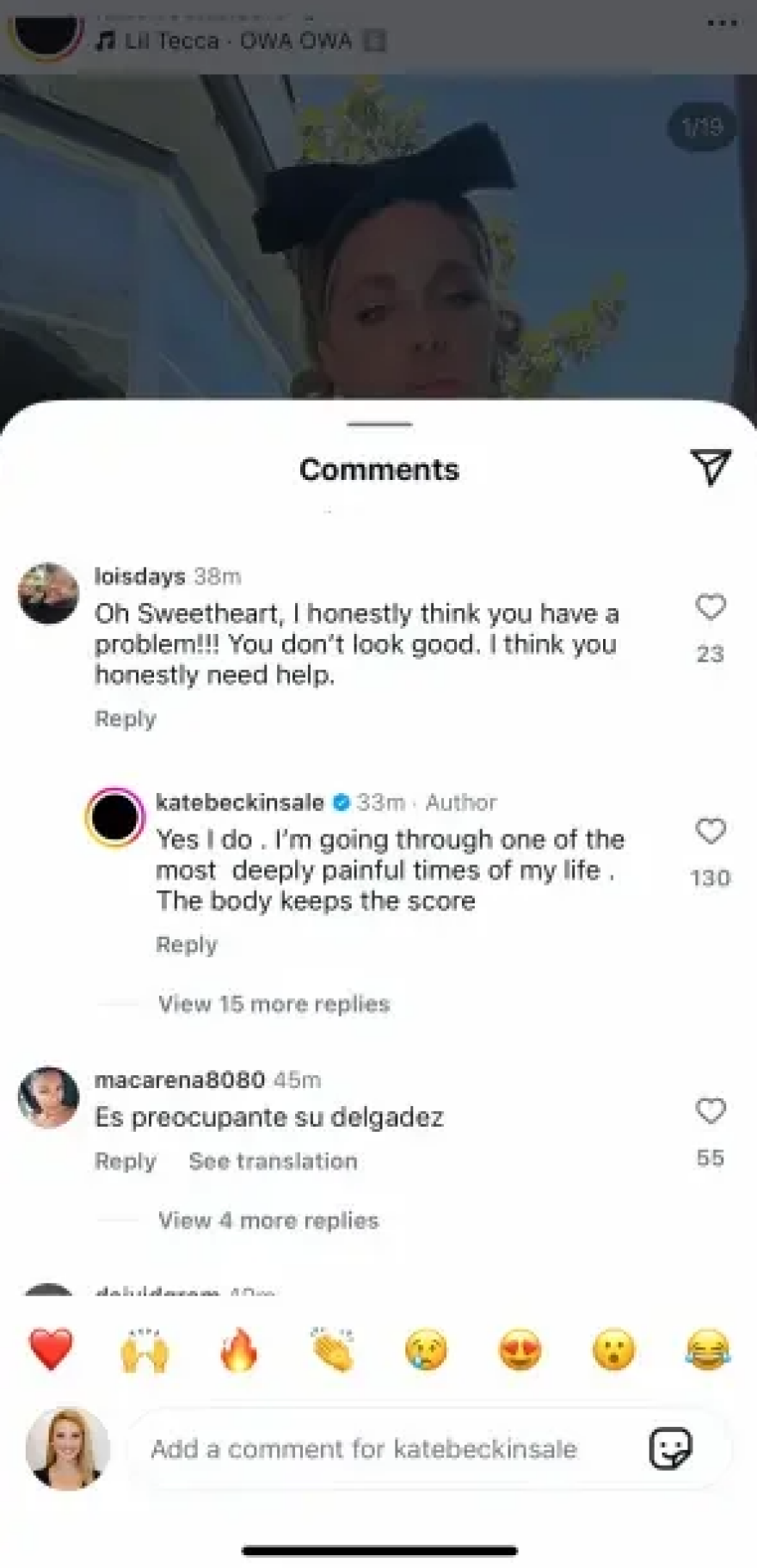 Κέιτ Μπέκινσεϊλ για την τεράστια απώλεια βάρους: Περνάω μία από τις πιο επώδυνες περιόδους της ζωής μου