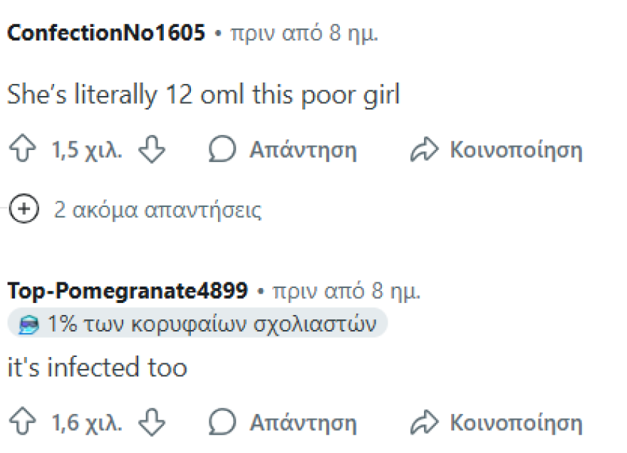 Κιμ Καρντάσιαν: Ξανά στο στόχαστρο - Η 12χρονη κόρη της εμφανίστηκε με piercing στο δάχτυλό της