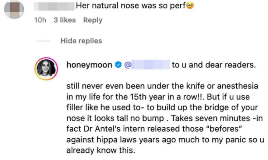 Η Λάνα Ντελ Ρέι διέψευσε τις φήμες ότι έχει κάνει πλαστική επέμβαση στη μύτη της

