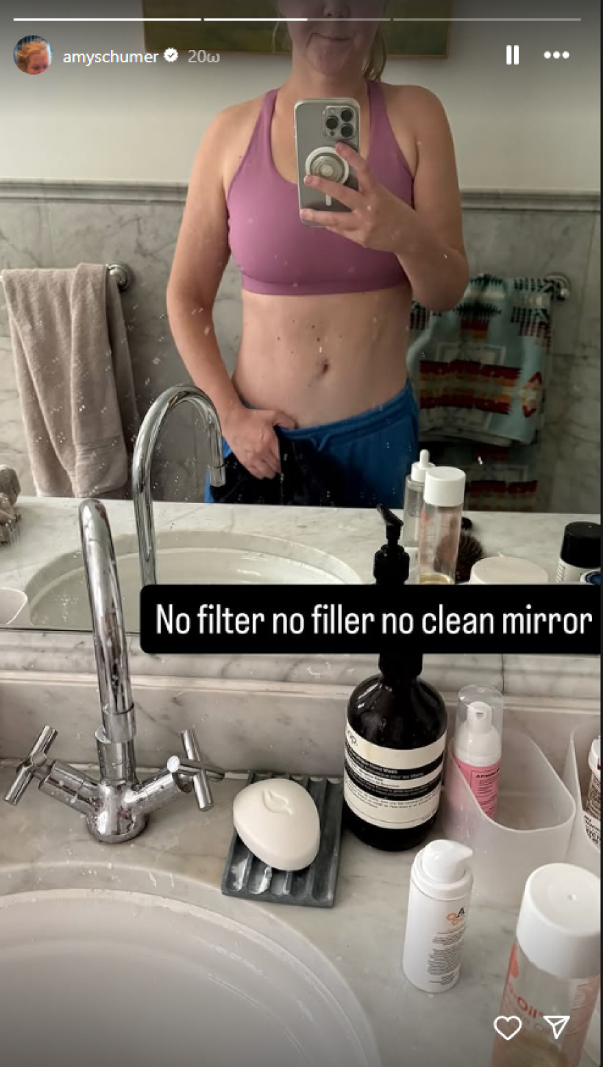 Έιμι Σούμερ για την απώλεια κιλών και την αλλαγή στην εμφάνισή της: Μου αρέσει η εικόνα μου, αλλά όλα έχουν να κάνουν με το πώς αισθάνεσαι