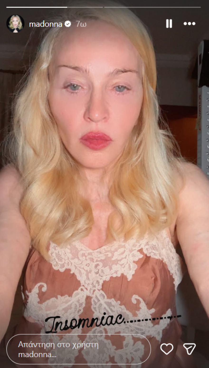 Η Μαντόνα δημοσίευσε selfie χωρίς μακιγιάζ
