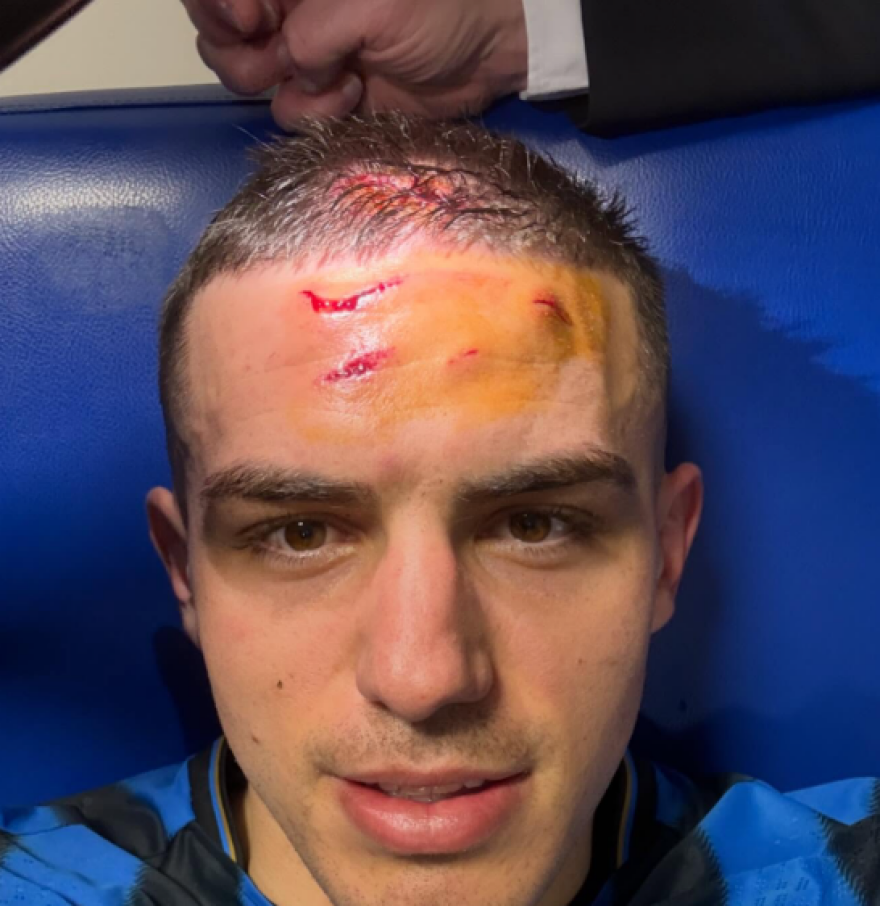 Αταλάντα: Η σοκαριστική φωτογραφία του Κρστόβιτς από την κλωτσιά του Μπενσεμπαϊνί
