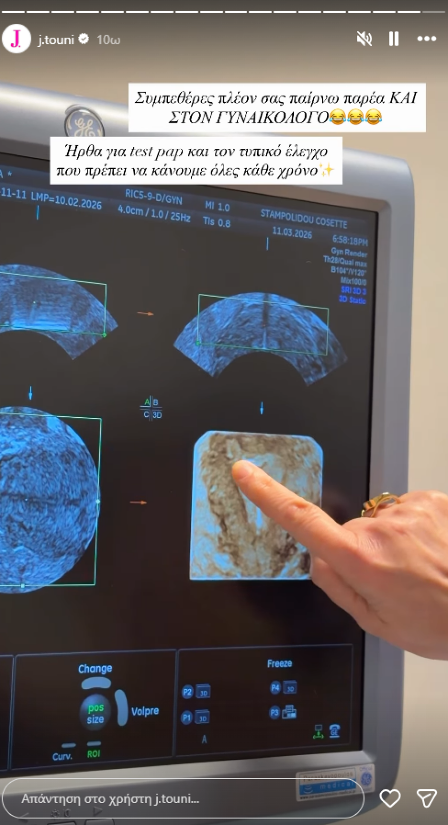 Ιωάννα Τούνη: Μου στείλατε 1.000 μηνύματα σε ένα λεπτό, δεν είμαι έγκυος