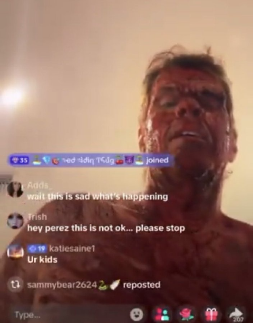 Ο blogger Πέρεζ Χίλτον έκανε live ματωμένος στο TikTok, τον μετέφεραν στο νοσοκομείο